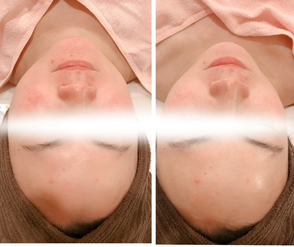 フェイシャル体験のお客様